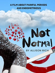Not Normal - Allison Rich